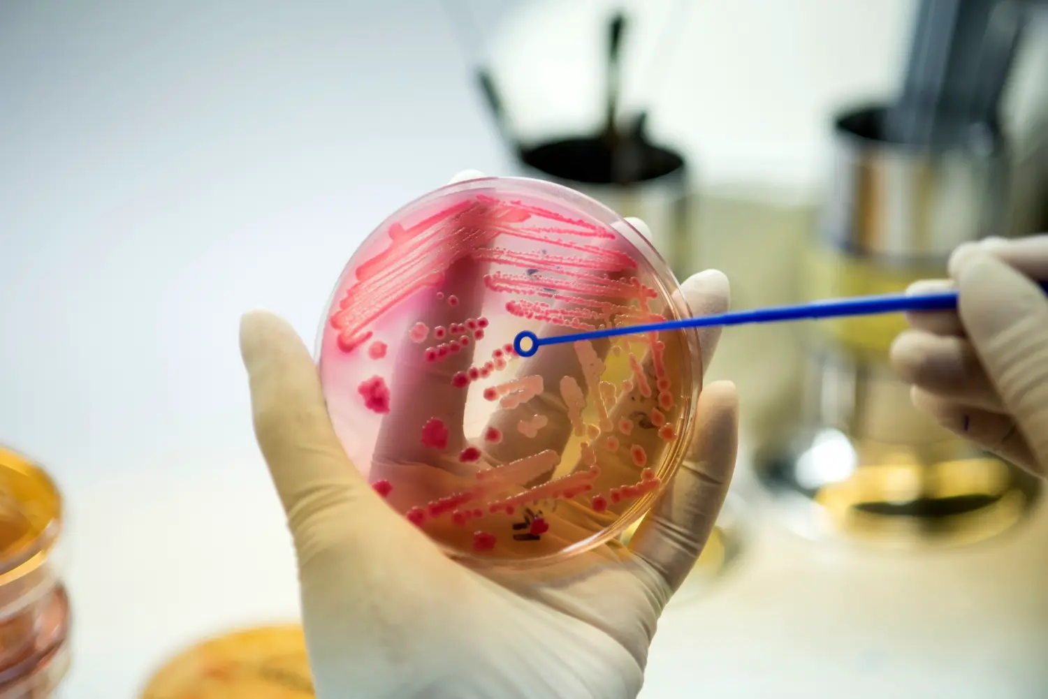 Do you know “dysbiosis”?